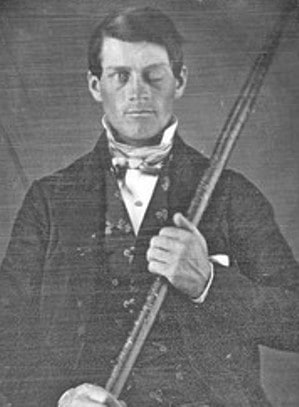 Phineas Gage. Public domain